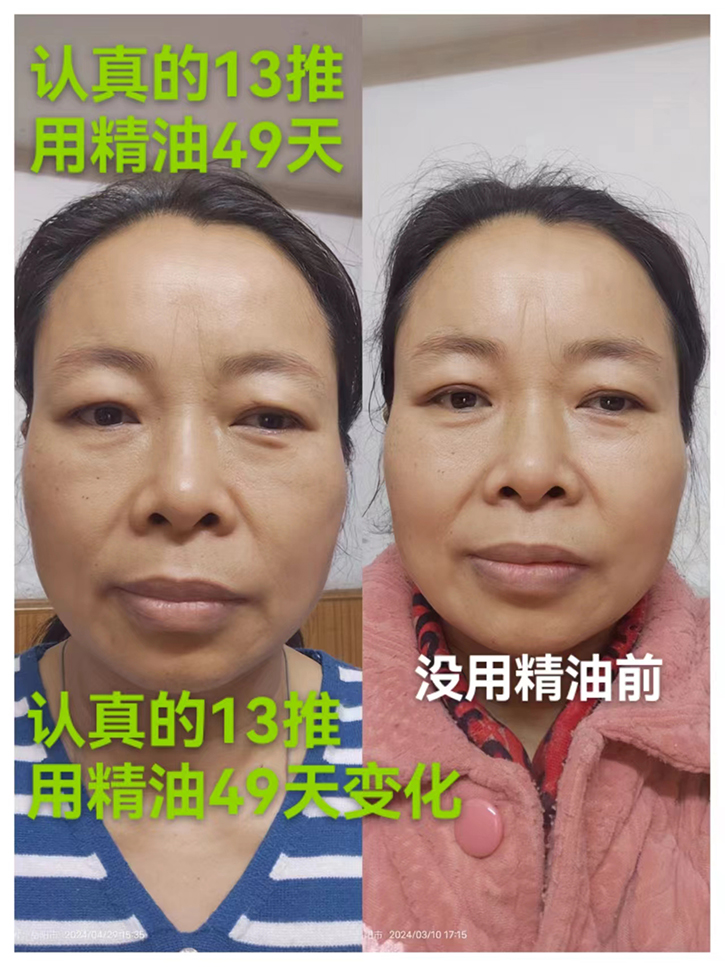 群友分享結(jié)緣十三推+用四季精油套裝49天后的喜悅心情！——年輕了，精神狀態(tài)好了！調(diào)理好幾年來的病痛！